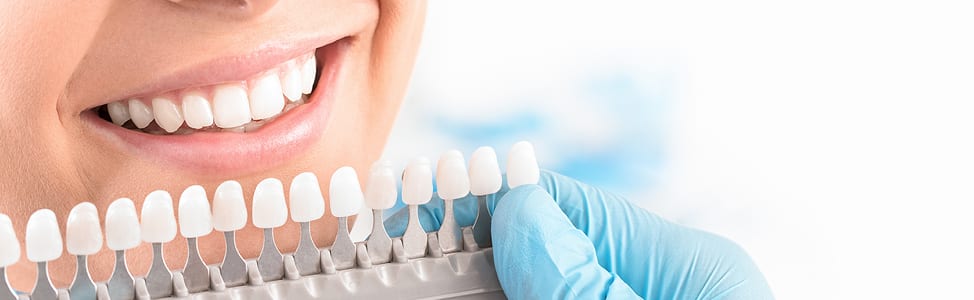 Teeth Whitening at Fort St. John Dental Clinic, BC